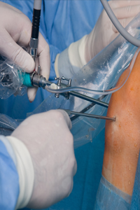 open knee surgery